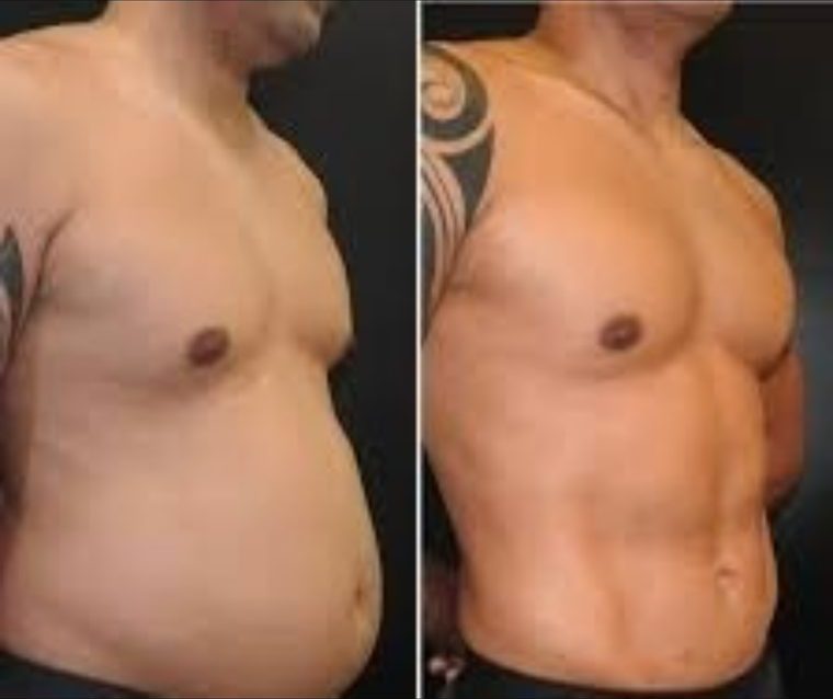 Cosmetic Surgery