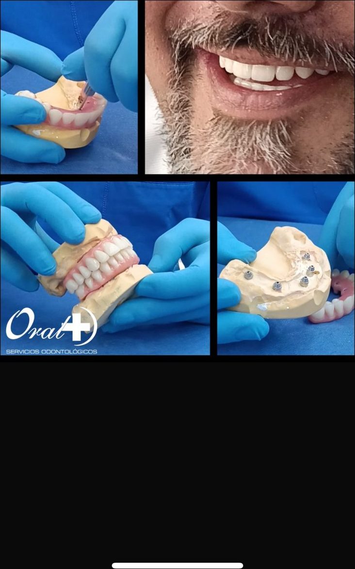 Dental Treatments