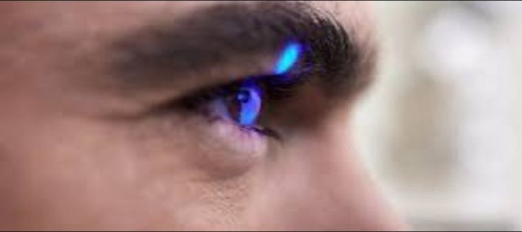 LASIK Eye Surgery